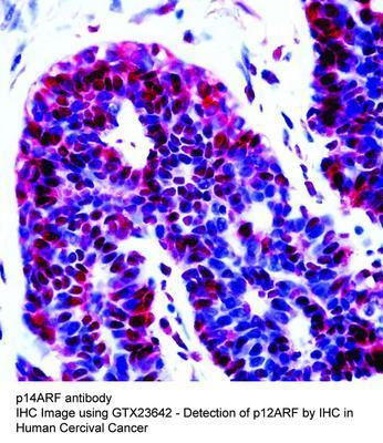 p14ARF antibody, GeneTex