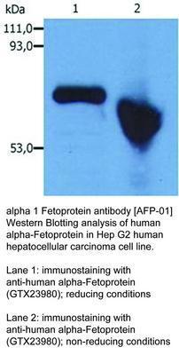 alpha 1 Fetoprotein antibody [AFP-01], GeneTex