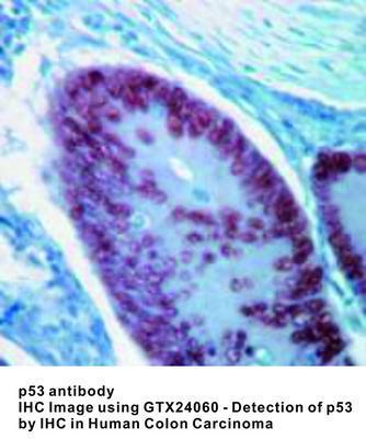 p53 antibody - 500µl, GeneTex