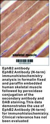 EphB2 antibody - Rabbit Polyclonal - ELISA, IHC-P, WB - 100µg, GeneTex