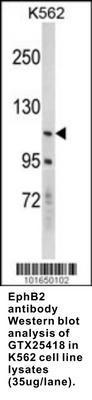 EphB2 antibody - Rabbit Polyclonal - ELISA, IHC-P, WB - 100µg, GeneTex