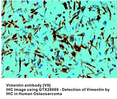 Vimentin antibody [V9], GeneTex