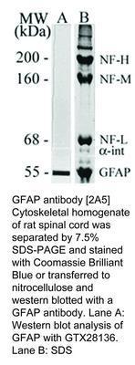 GFAP antibody [2A5], GeneTex