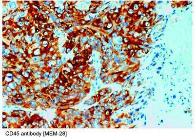 CD45 antibody [MEM-28], GeneTex