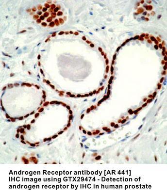 Androgen Receptor antibody [AR 441], GeneTex