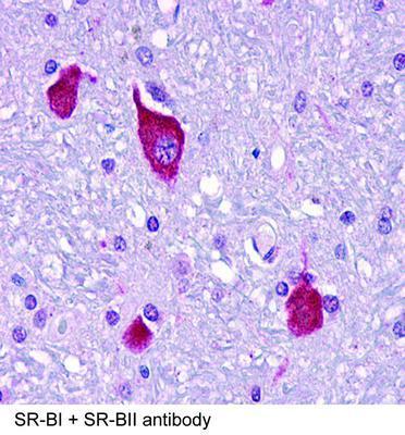 SR-BI + SR-BII antibody, GeneTex