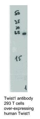 Twist1 antibody, GeneTex