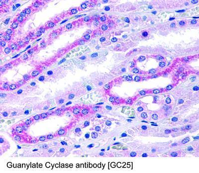 Guanylate Cyclase antibody [GC25], GeneTex