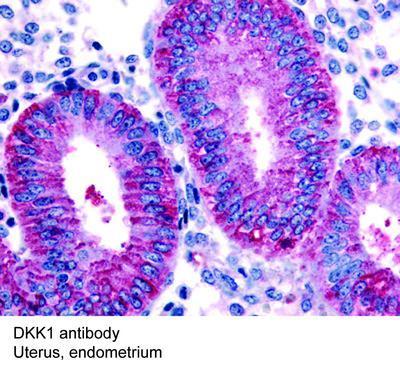 DKK1 antibody, GeneTex