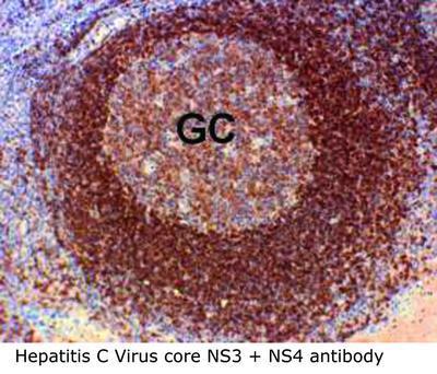 Hepatitis C Virus core NS3 + NS4 antibody, GeneTex