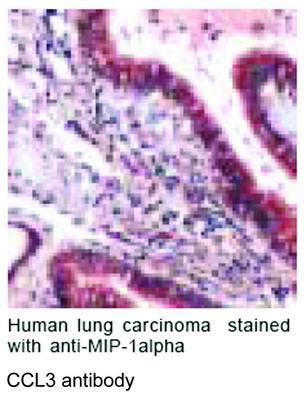 CCL3 antibody, GeneTex