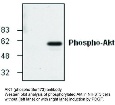 AKT (phospho Ser473) antibody, GeneTex