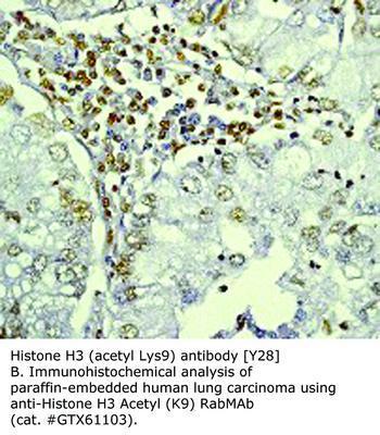 Histone H3 (acetyl Lys9) antibody [Y28], GeneTex