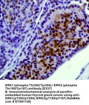 ERK1 (phospho Thr202/Tyr204) / ERK2 (phospho Thr185/Tyr187) antibody [E337], GeneTex