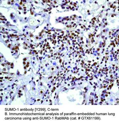 SUMO-1 antibody [Y299], C-term, GeneTex