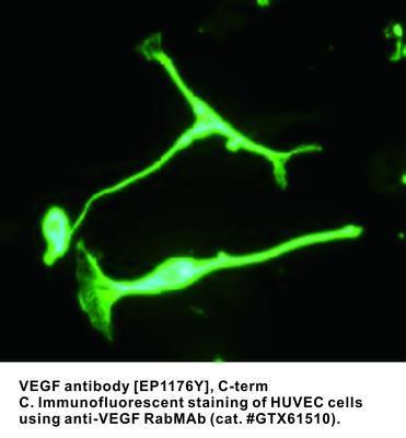 VEGF antibody [EP1176Y], C-term, GeneTex