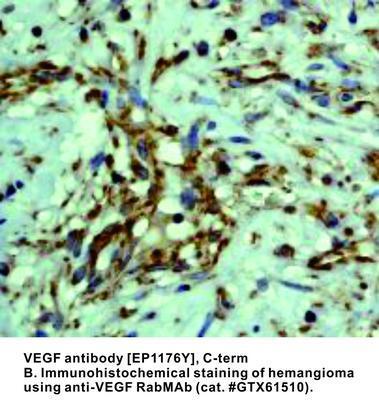 VEGF antibody [EP1176Y], C-term, GeneTex