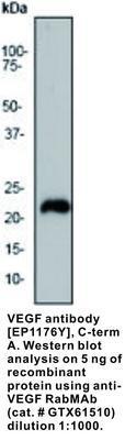 VEGF antibody [EP1176Y], C-term, GeneTex