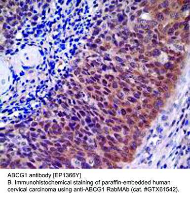 ABCG1 antibody [EP1366Y], GeneTex