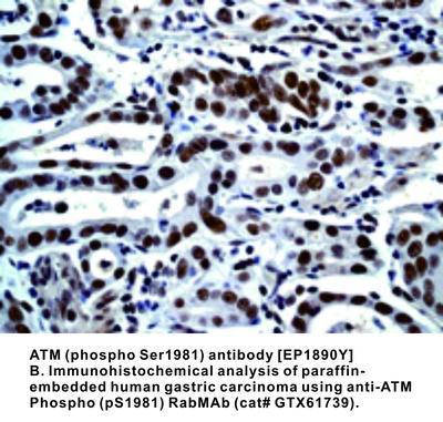 ATM (phospho Ser1981) antibody [EP1890Y], GeneTex