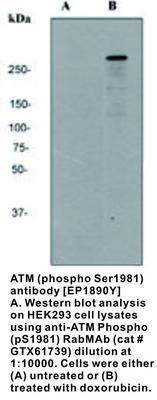 ATM (phospho Ser1981) antibody [EP1890Y], GeneTex