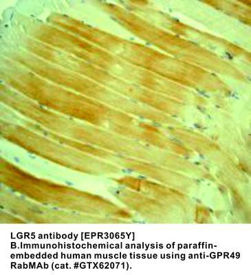 LGR5 antibody [EPR3065Y], GeneTex