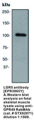 LGR5 antibody [EPR3065Y], GeneTex