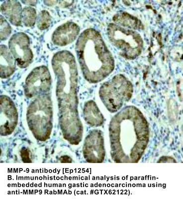 MMP-9 antibody [EP1254], GeneTex