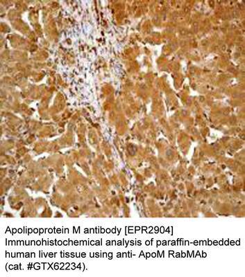 Apolipoprotein M antibody [EPR2904], GeneTex