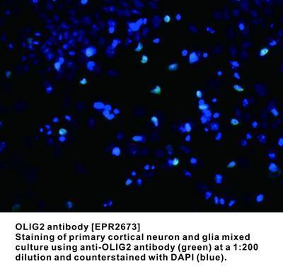 OLIG2 antibody [EPR2673], GeneTex