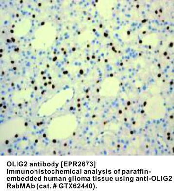 OLIG2 antibody [EPR2673], GeneTex