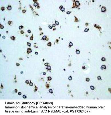 Lamin A/C antibody [EPR4068], GeneTex