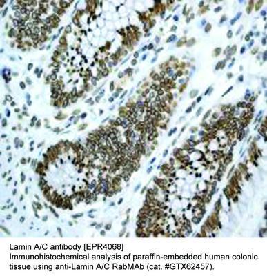 Lamin A/C antibody [EPR4068], GeneTex