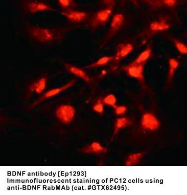 BDNF antibody [EP1293], GeneTex