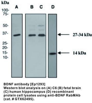 BDNF antibody [EP1293], GeneTex