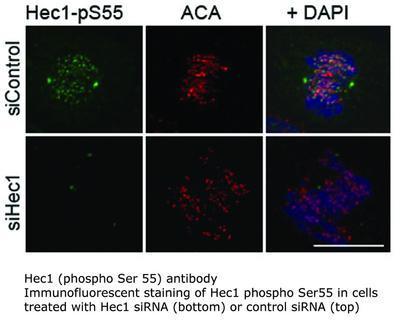 Hec1 (phospho Ser 55) antibody, GeneTex