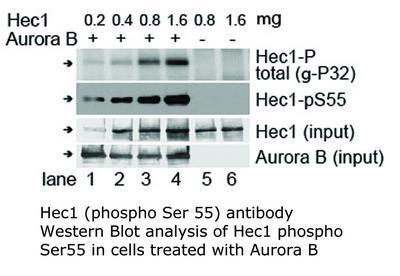 Hec1 (phospho Ser 55) antibody, GeneTex