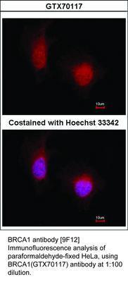 BRCA1 antibody [9F12], GeneTex