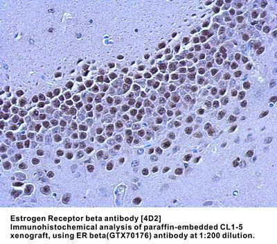 Estrogen Receptor beta antibody [4D2], GeneTex