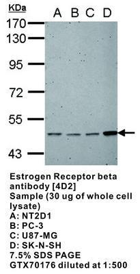 Estrogen Receptor beta antibody [4D2], GeneTex