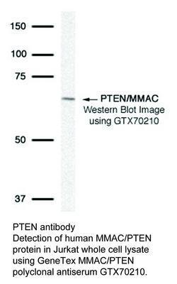 PTEN antibody - 50µl, GeneTex