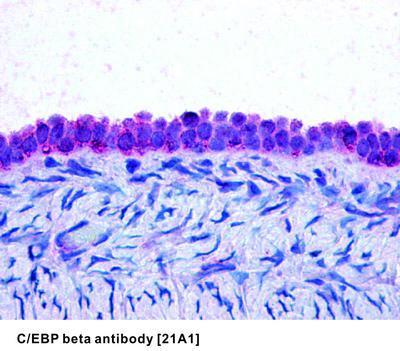 C/EBP beta antibody [21A1], GeneTex