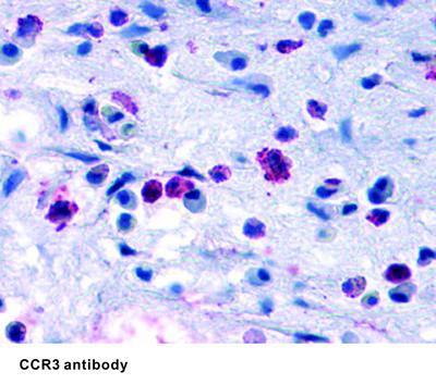 CCR3 antibody - 25µg, GeneTex