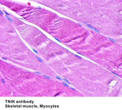 TNIK antibody - Rabbit Polyclonal - IHC-P - 25µg, GeneTex