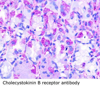 Cholecystokinin B receptor antibody, GeneTex