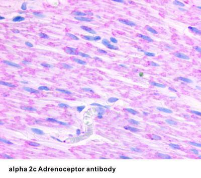 alpha 2c Adrenoceptor antibody, GeneTex