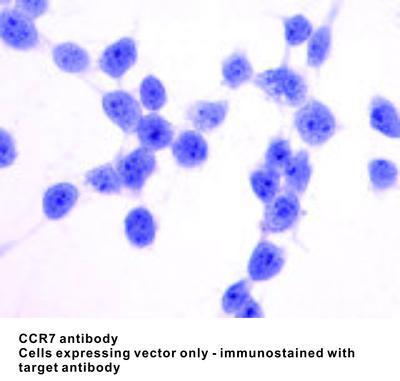 CCR7 antibody (C-Terminus), GeneTex