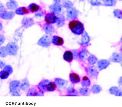 CCR7 antibody (C-Terminus), GeneTex