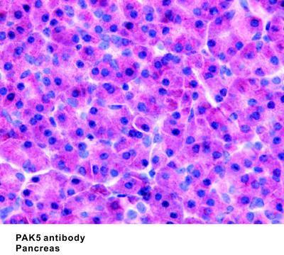 PAK5 antibody, GeneTex