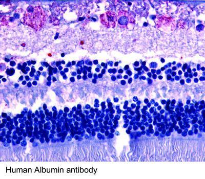 Human Albumin antibody - 500µg, GeneTex